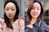 '조혜련 올케' 박혜민, 코 성형 이후 '나도 코버지 있다' 만족감 드러내