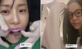 고현정, 치과 굴욕 사진까지 올렸다...  '스타도 치과는 무서워요ㅠㅠ'