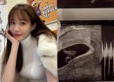 '임신사실' 고백한 뒤 남친 신상 폭로한 서민재... '아이에 부끄럽지 않게 살 것'