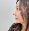 '조혜련 올케' 박혜민, 코 수술 '대박' 근황 전했다