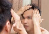 머리카락 빠진 게 성병 징후였다... ''이런 탈모'는 매독 증상'