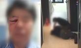 '미성년자 여학생 2명 숨어있어'... 모텔 출입 제지하자 아빠뻘 사장님 폭행한 06년생 남성들