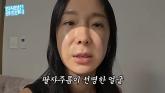 '46세' 이지혜, 미용 시술 고백하며 과정 공개... '노화 확실히 느껴져서' (영상)