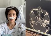 이현이, 2년 전 '안면 마비' 이어 '코뼈 골절'로 병원 입원... 무슨 일이?